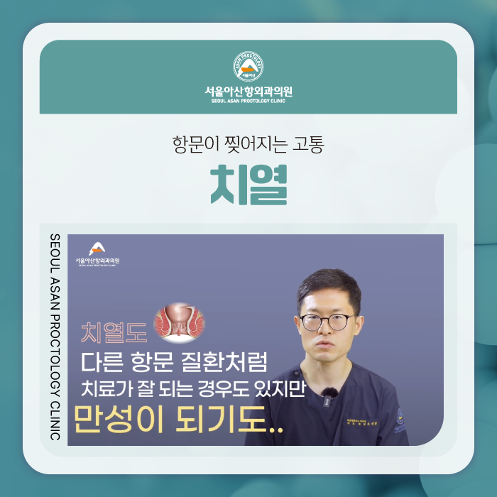 청주항문외과항문이 찢어지는 고통 치열이란?