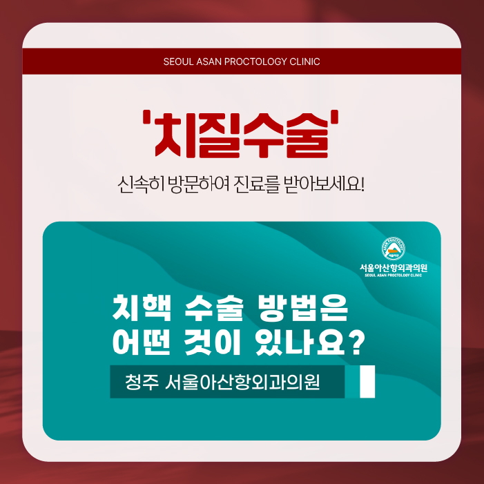 청주치질수술 어떤 경우에 진행하는 것이 좋을까?