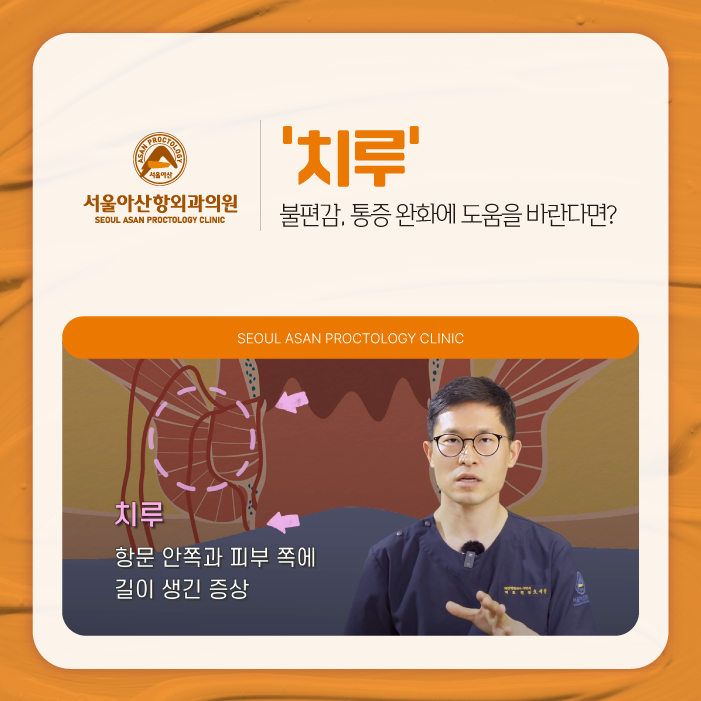 청주항문외과, 치루의 불편감과 통증 완화가 간절하다면?